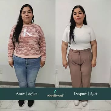 Slider image (8) Obesity Out Bariatric Surgery Center